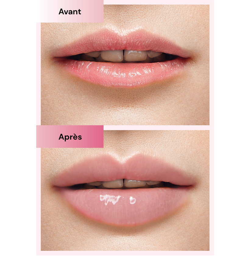 Le Kit + 2 Recharges - Pulp Lips
